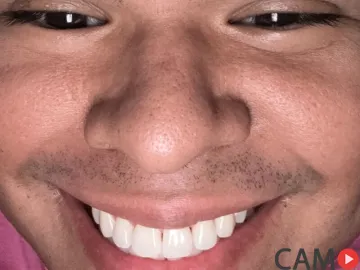 Mathjimmy’s (LiveJasmin) Photo